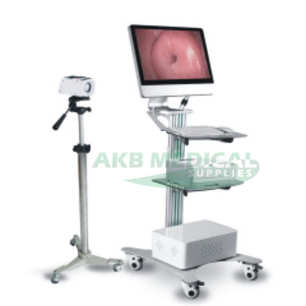 Gynecology Video Colposcope YSSW3303