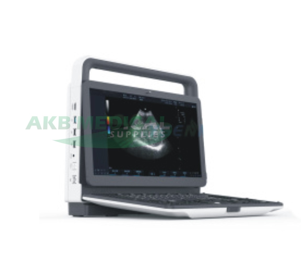YSB-M30 Top Sale 3D 4D Portable Color Doppler Ultrasound Machine Scanner With Low Price