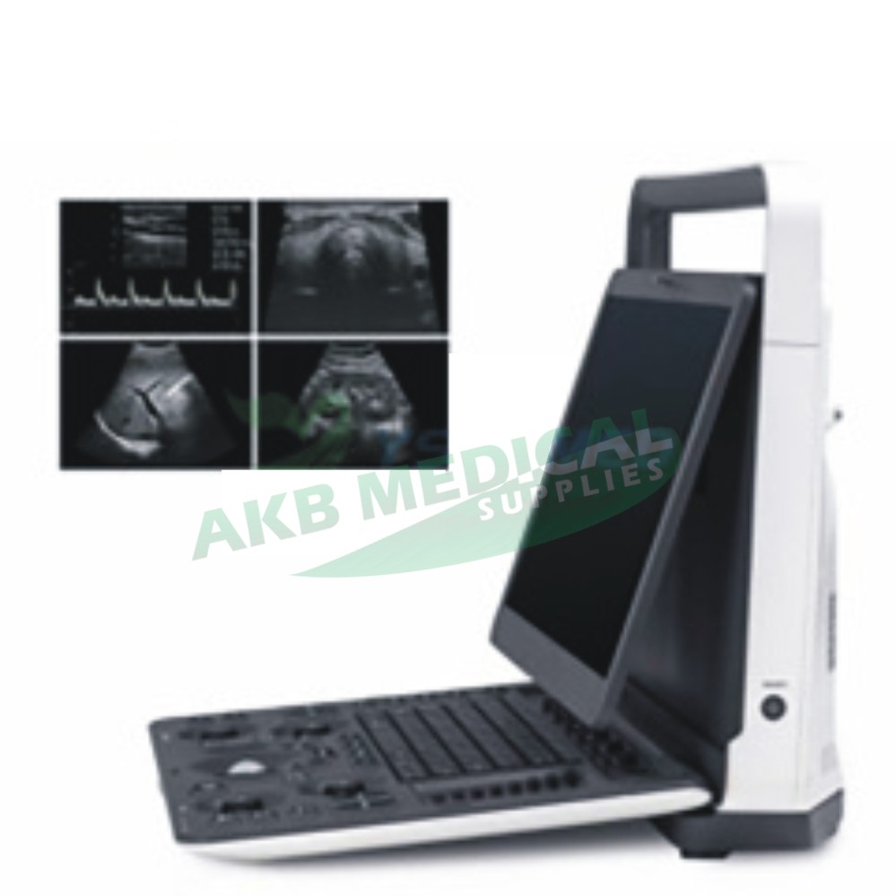Sonoscape E1 portable black and white ultrasound machine
